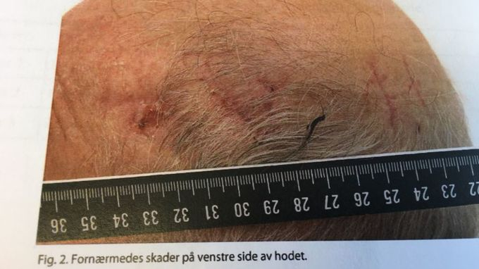 Mann (29) slo pensjonist i hodet med stein i Åsane – aktor krever fem års forvaring