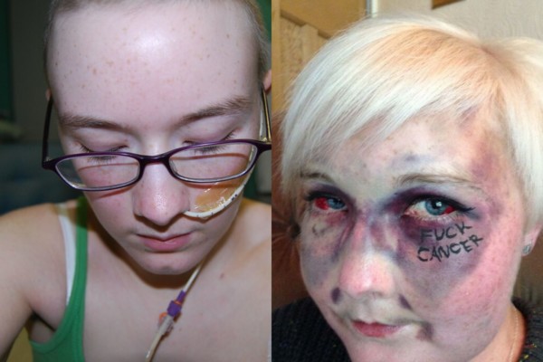 Kathryn Cartwright  (28) falt ut av rullestolen og slo seg kraftig i ansiktet, og så skrev hun «Fuck cancer». Nå er hun død.