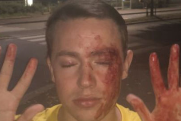 Edvin Eriksen (22) ble utsatt for vold på bussen – en mann er siktet